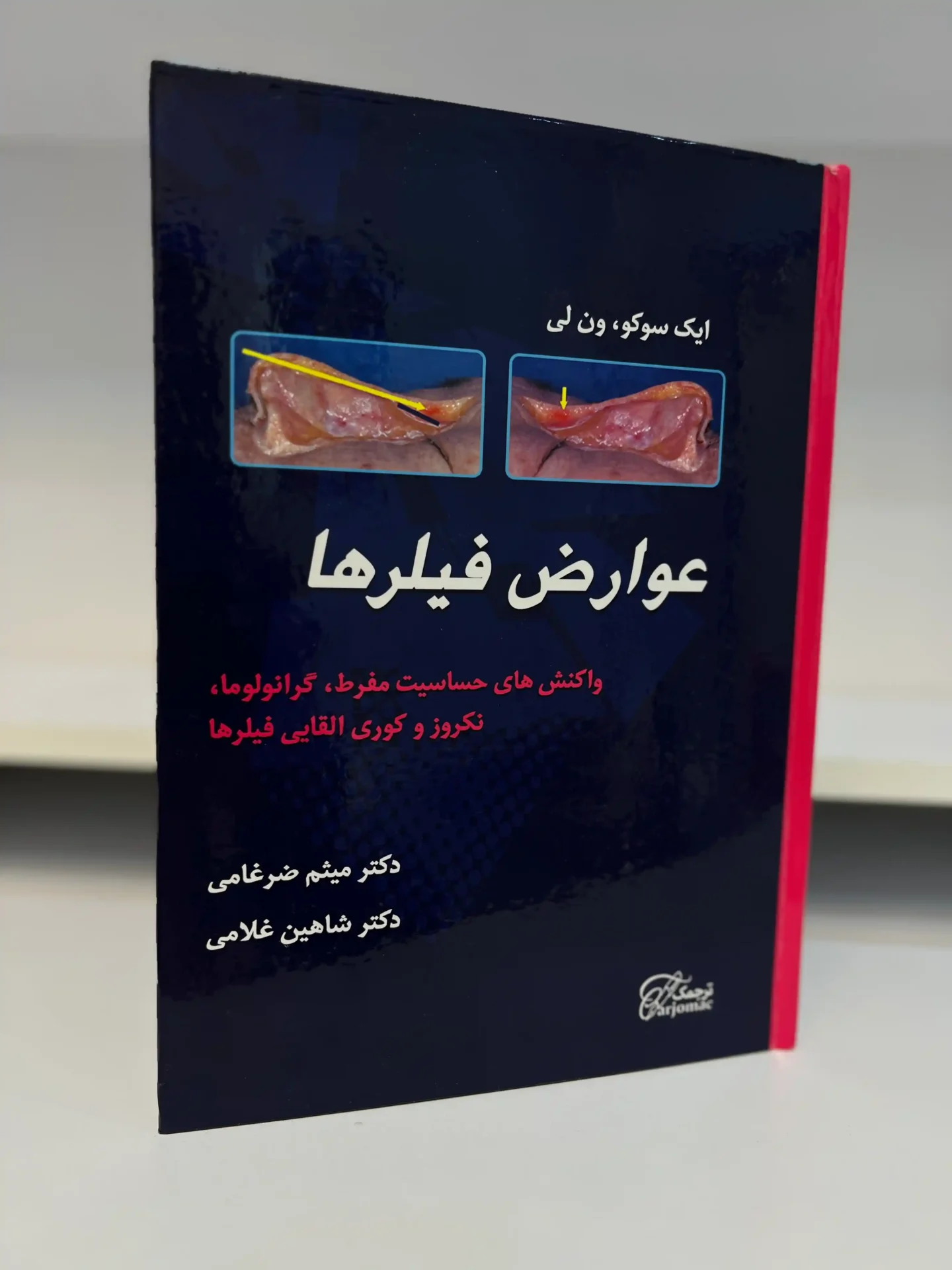 Dr. Zarghami's book on the complications of fillers